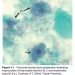 Cryptosporidiosis, Giardiasis, and Other Intestinal Protozoan Diseases Research Paper