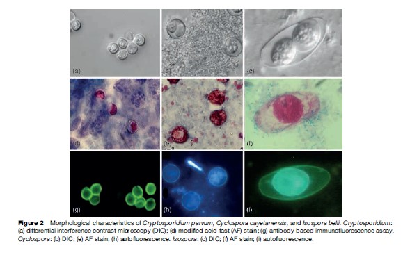 Cryptosporidiosis, Giardiasis, and Other Intestinal Protozoan Diseases Research Paper