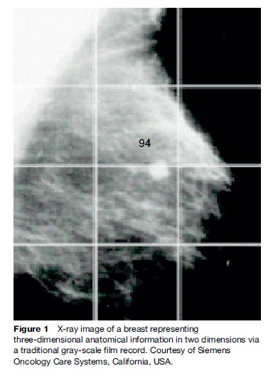 Radiation Therapy Research Paper