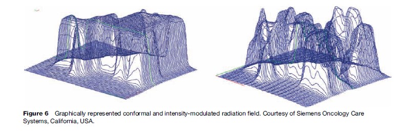 Radiation Therapy Research Paper