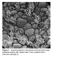 Rhinoviruses Research Paper
