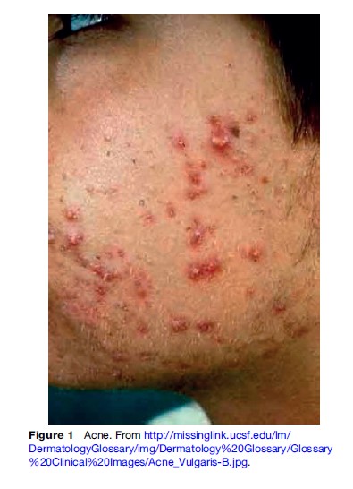 Skin Diseases Research Paper