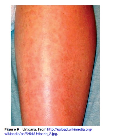Skin Diseases Research Paper