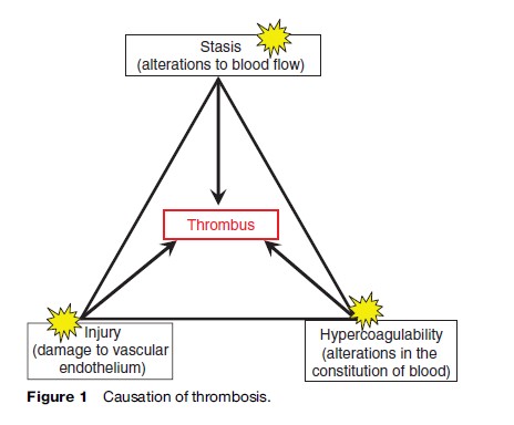 Venous Thromboembolism (VTE) Research Paper